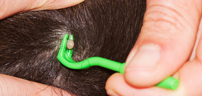 pinza rimuovere zecca